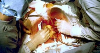 La salud de Leo - LeoHoy.net